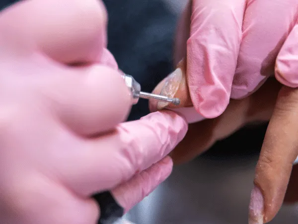 Ammollo dell'acrilico con solvente specifico